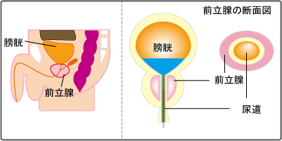 前立腺の断面図